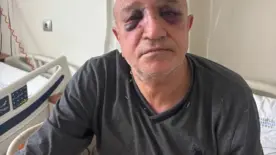İzmir Büfeciler ve Kantinciler oda başkanına hain saldırı