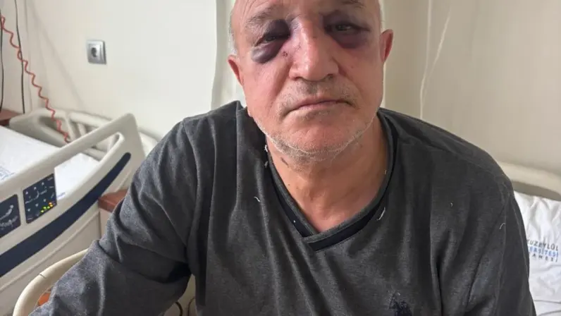 İzmir Büfeciler ve Kantinciler oda başkanına hain saldırı